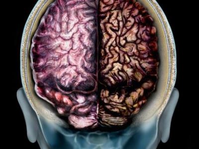 Scoperta una molecola che ringiovanisce il cervello e blocca l’Alzheimer